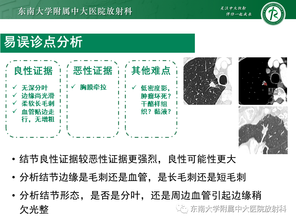 影像PPT - 【PPT】孤立性肺结节影像诊断-39