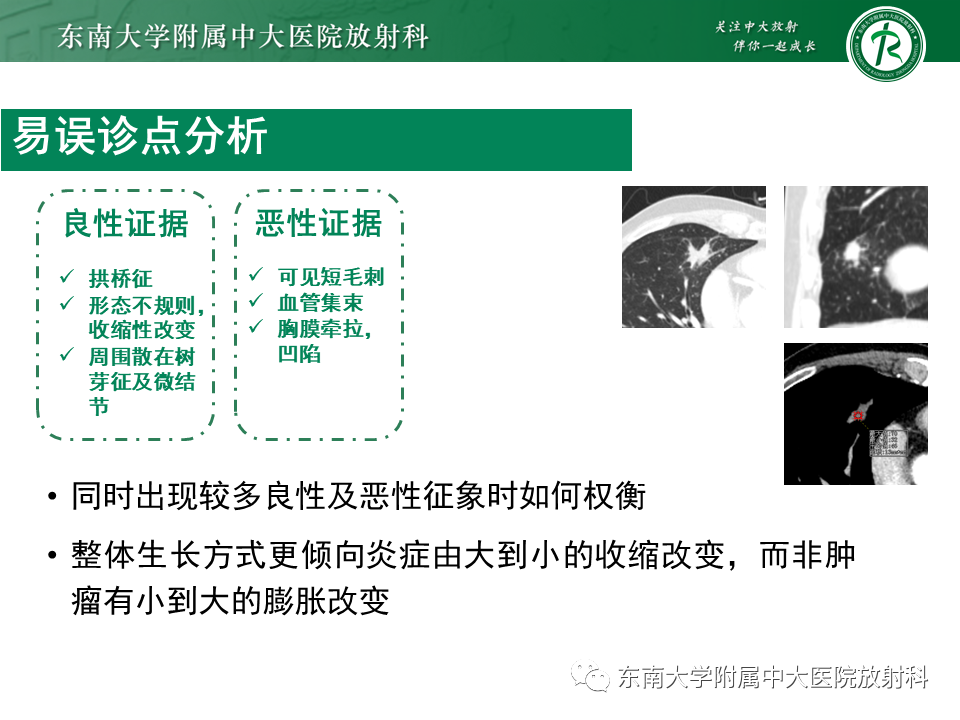 影像PPT - 【PPT】孤立性肺结节影像诊断-41