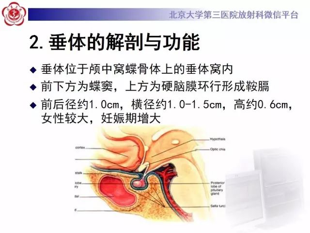 影像PPT - 【PPT】中枢性尿崩症影像诊断-9