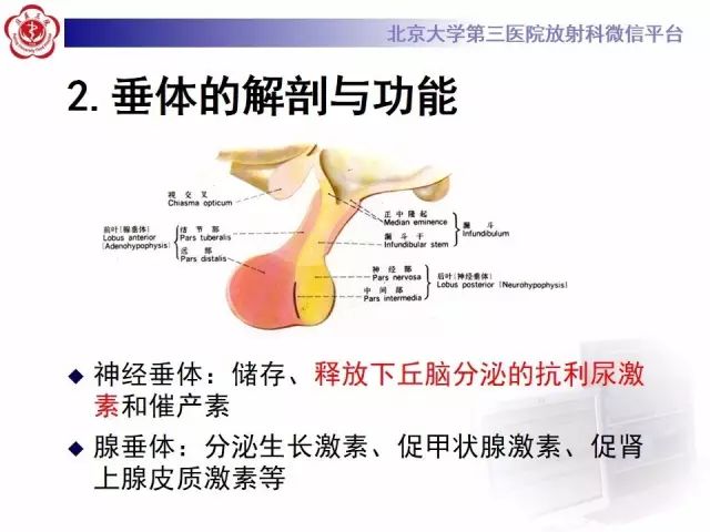 影像PPT - 【PPT】中枢性尿崩症影像诊断-8