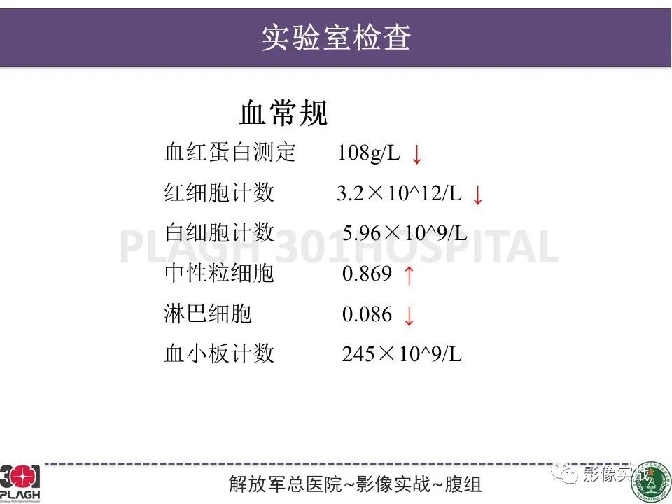 影像PPT - 【病例】子宫内膜息肉1例MR影像-3