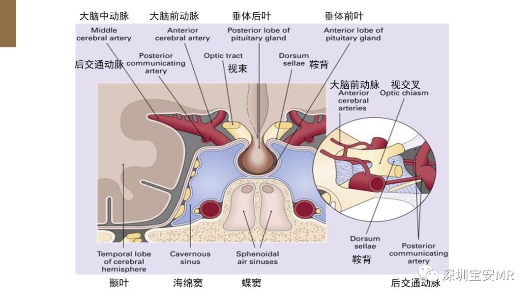 影像PPT - 【PPT】垂体磁共振影像解剖-5