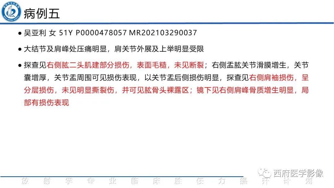 影像PPT - 【PPT】肩峰下撞击综合征影像表现-10