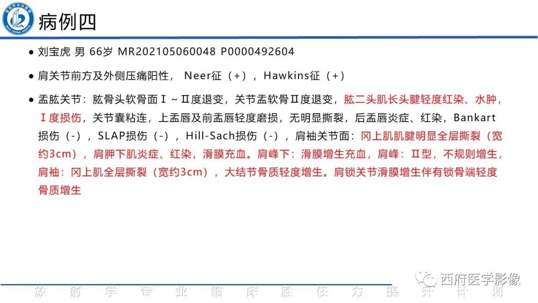 影像PPT - 【PPT】肩峰下撞击综合征影像表现-8
