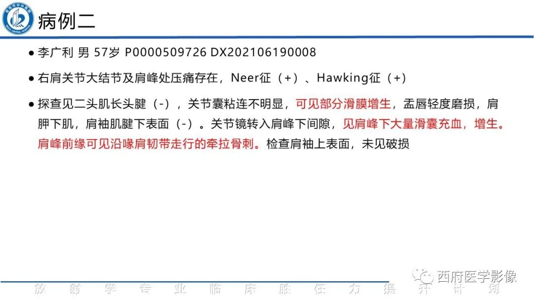 影像PPT - 【PPT】肩峰下撞击综合征影像表现-4