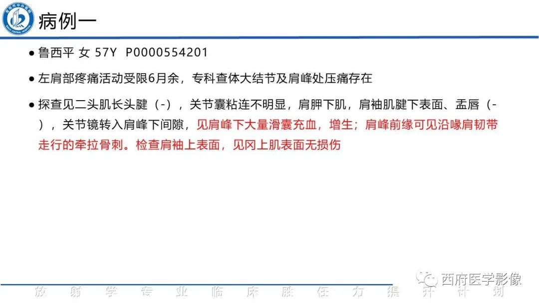 影像PPT - 【PPT】肩峰下撞击综合征影像表现-2
