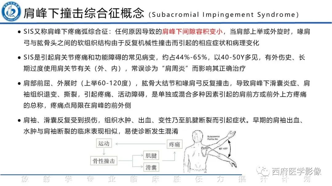 影像PPT - 【PPT】肩峰下撞击综合征影像表现-12