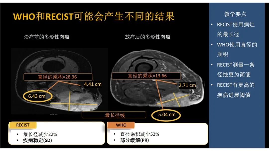 影像PPT - 【PPT】软组织肉瘤:评估治疗反应的影像学指南回顾-15