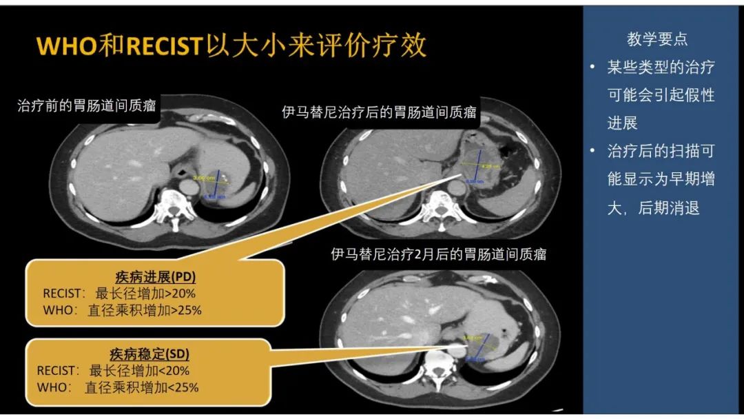 影像PPT - 【PPT】软组织肉瘤:评估治疗反应的影像学指南回顾-19
