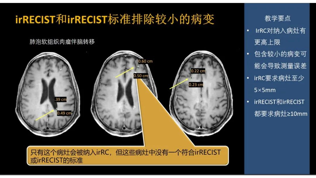 影像PPT - 【PPT】软组织肉瘤:评估治疗反应的影像学指南回顾-23