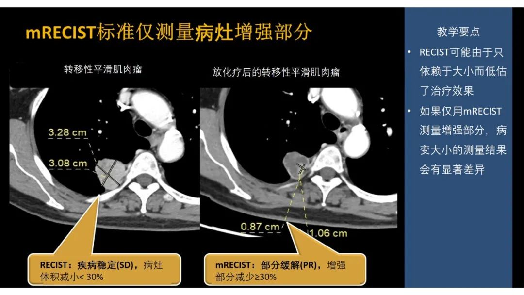 影像PPT - 【PPT】软组织肉瘤:评估治疗反应的影像学指南回顾-33