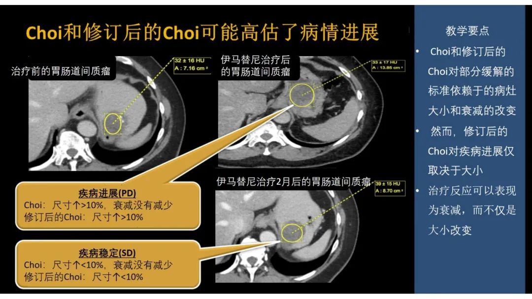 影像PPT - 【PPT】软组织肉瘤:评估治疗反应的影像学指南回顾-45