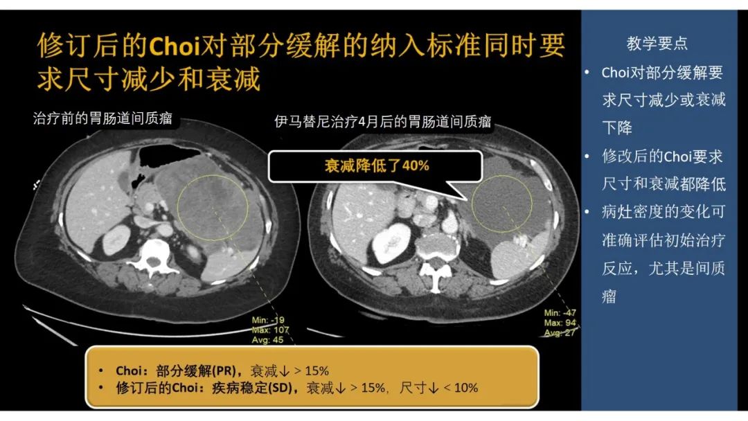 影像PPT - 【PPT】软组织肉瘤:评估治疗反应的影像学指南回顾-47