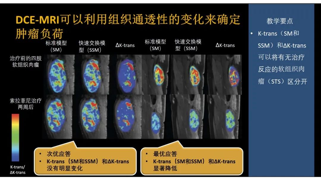 影像PPT - 【PPT】软组织肉瘤:评估治疗反应的影像学指南回顾-65