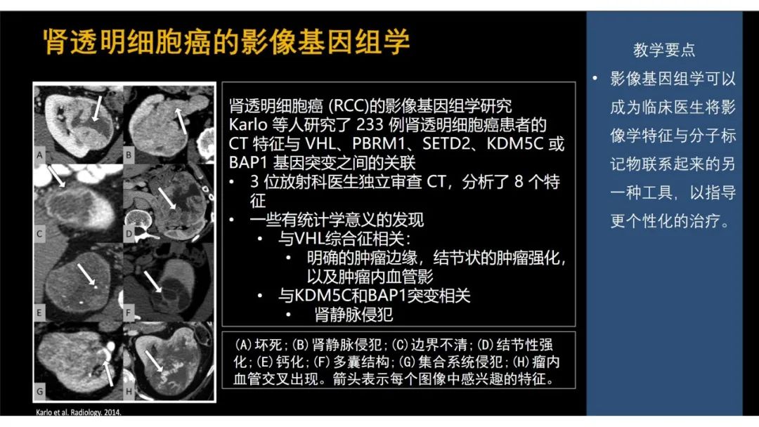 影像PPT - 【PPT】软组织肉瘤:评估治疗反应的影像学指南回顾-79