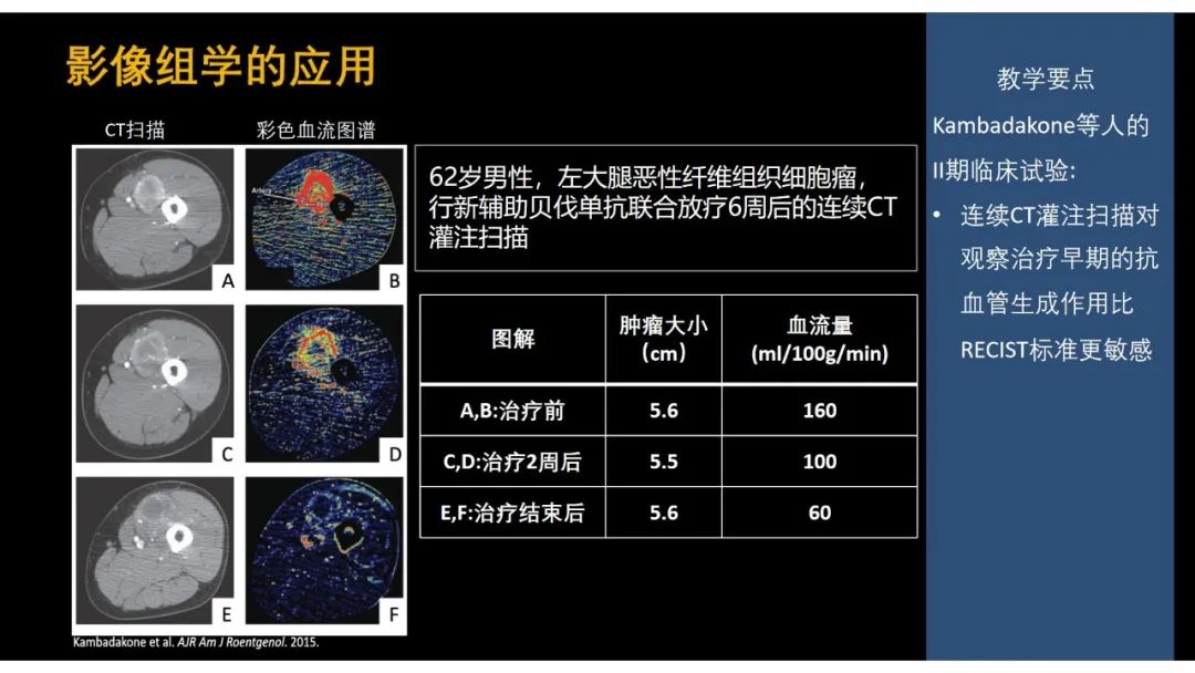 影像PPT - 【PPT】软组织肉瘤:评估治疗反应的影像学指南回顾-75