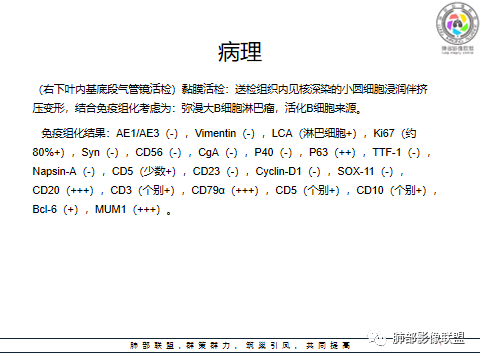 影像PPT - 【病例】肺部弥漫大B细胞淋巴瘤1例CT影像讨论-60 影像PPT - 【病例】肺部弥漫大B细胞淋巴瘤1例CT影像讨论-60