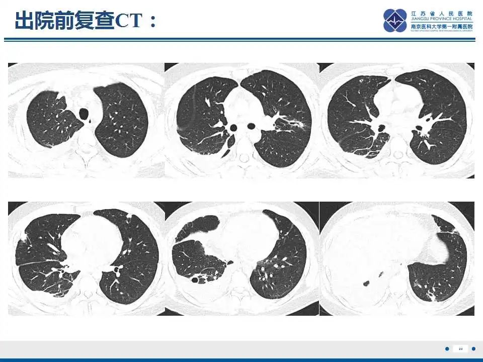 影像PPT - 【PPT】坏死梭杆菌肺炎-21