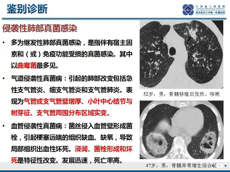 影像PPT - 【PPT】坏死梭杆菌肺炎-38