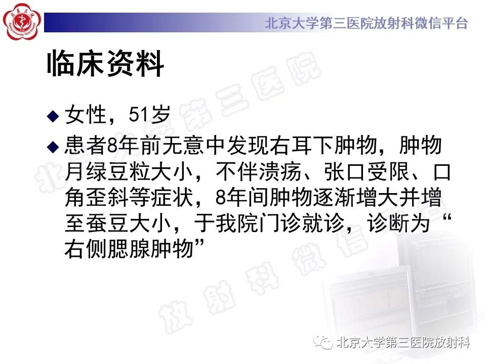 影像PPT - 【PPT】腮腺粘液表皮样癌-2