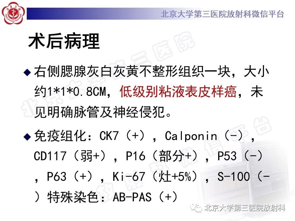 影像PPT - 【PPT】腮腺粘液表皮样癌-9
