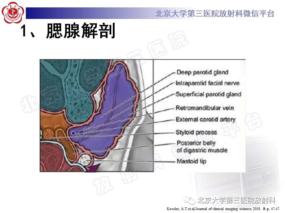 影像PPT - 【PPT】腮腺粘液表皮样癌-11
