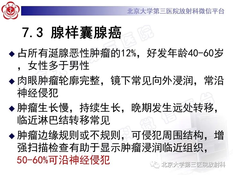 影像PPT - 【PPT】腮腺粘液表皮样癌-30