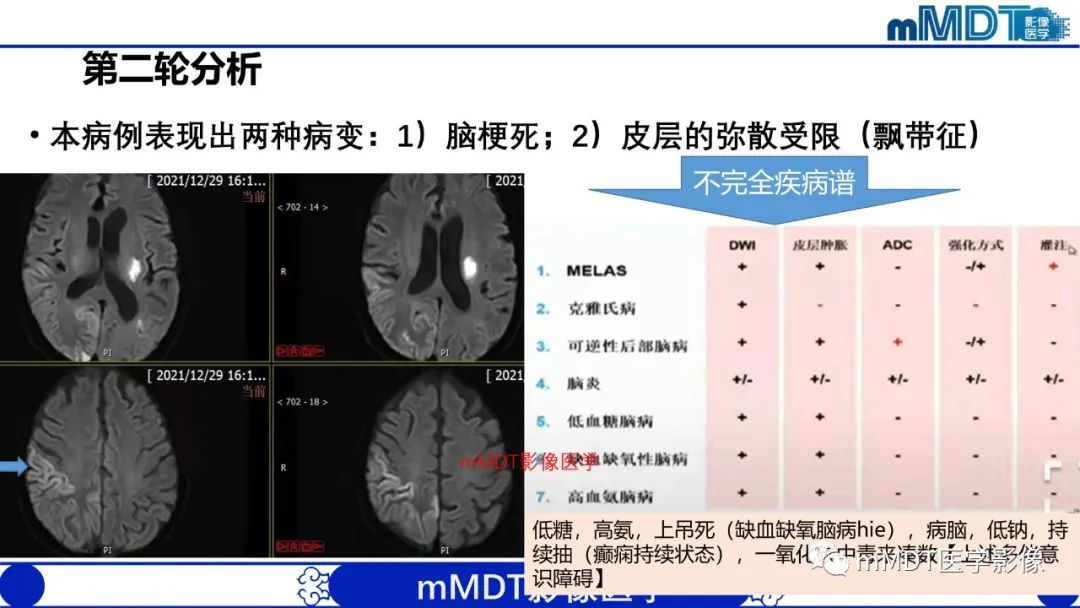 影像PPT - 【PPT】两例脑膜强化的隐球菌及综述-13