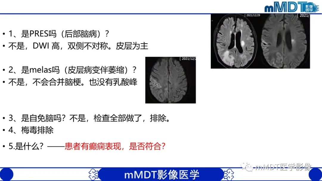 影像PPT - 【PPT】两例脑膜强化的隐球菌及综述-15