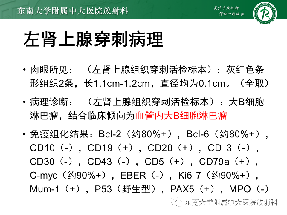 影像PPT - 【PPT】血管内大B细胞淋巴瘤-11 影像PPT - 【PPT】血管内大B细胞淋巴瘤-11