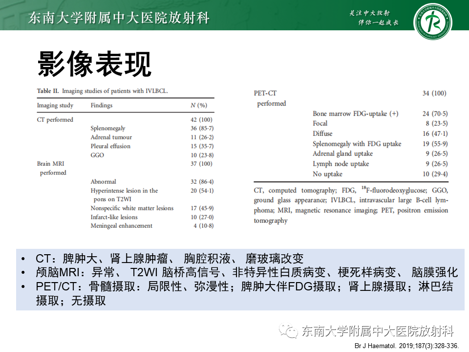 影像PPT - 【PPT】血管内大B细胞淋巴瘤-28 影像PPT - 【PPT】血管内大B细胞淋巴瘤-28