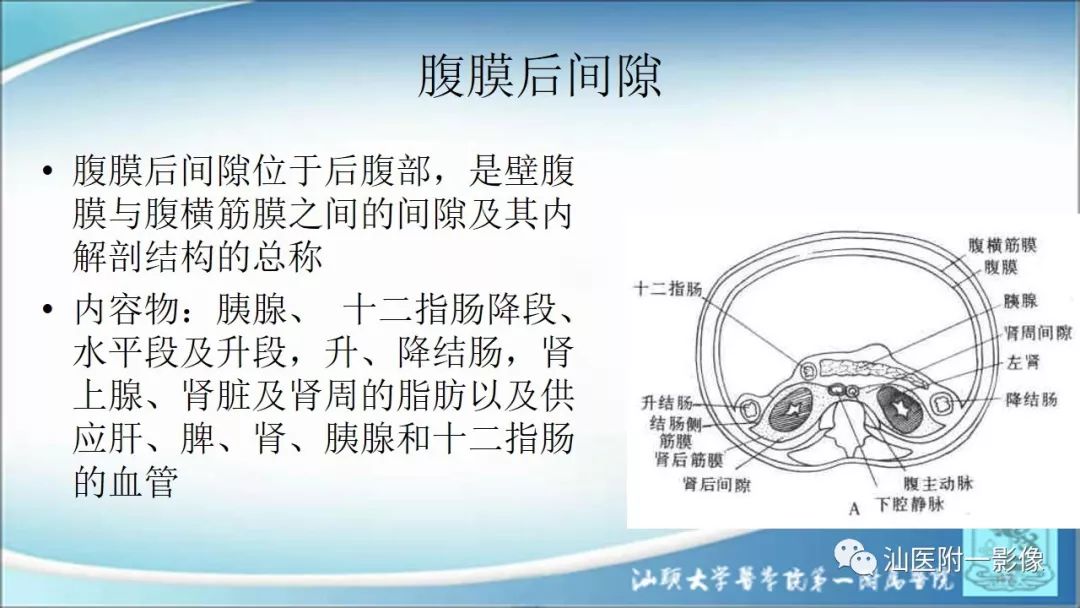 影像PPT - 【PPT】上腹囊性病变影像学分析-3