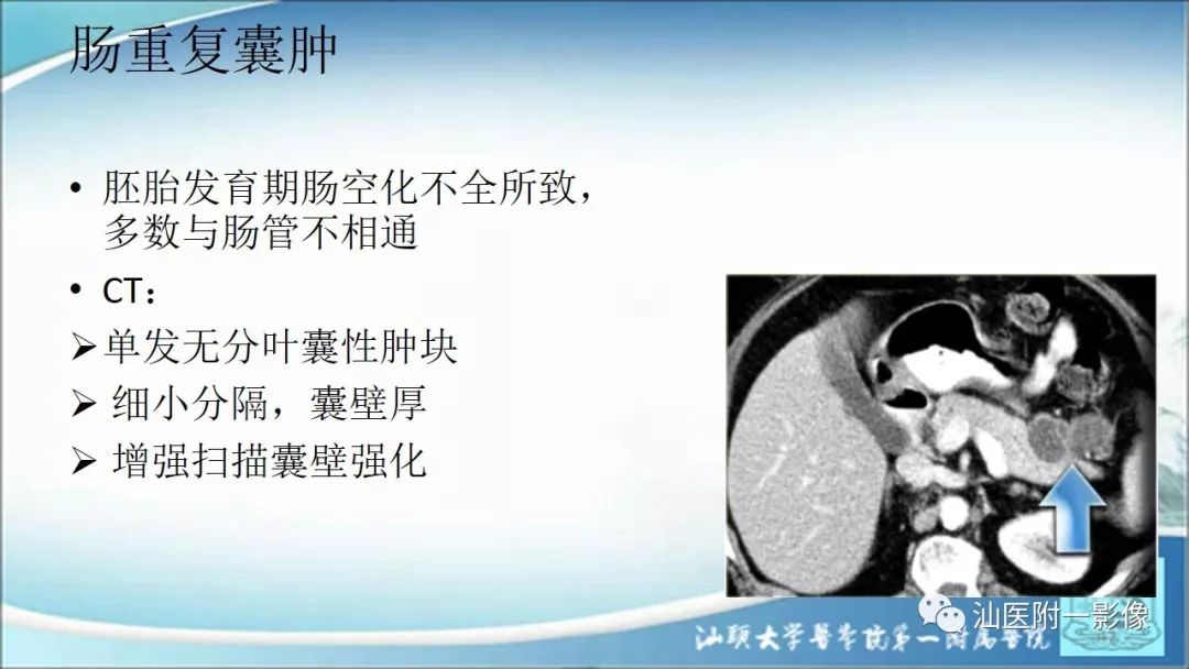影像PPT - 【PPT】上腹囊性病变影像学分析-11