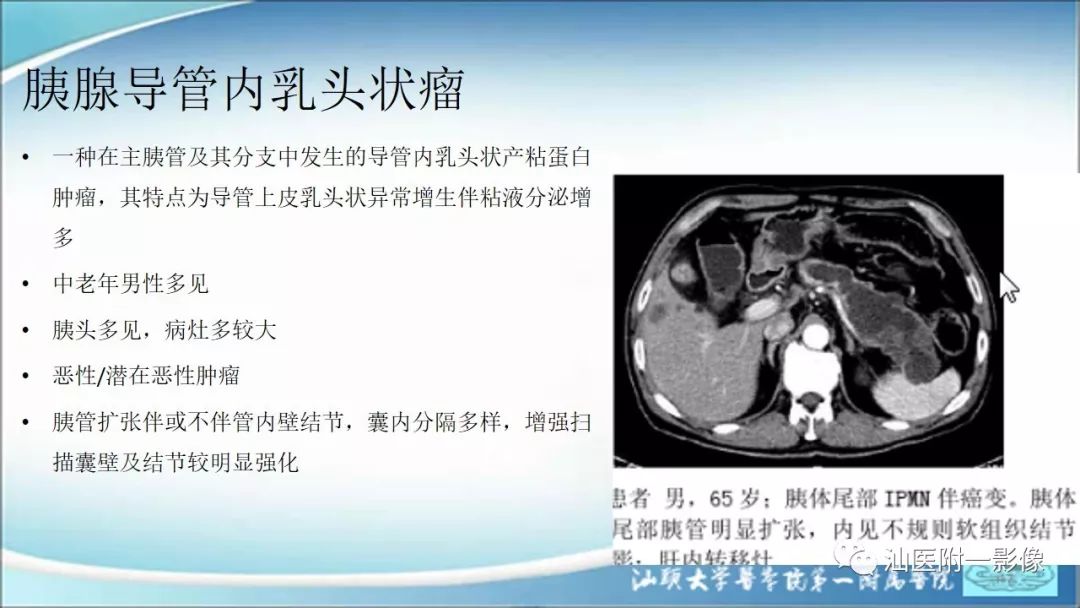 影像PPT - 【PPT】上腹囊性病变影像学分析-47