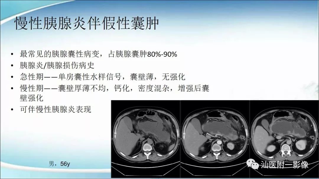 影像PPT - 【PPT】上腹囊性病变影像学分析-49