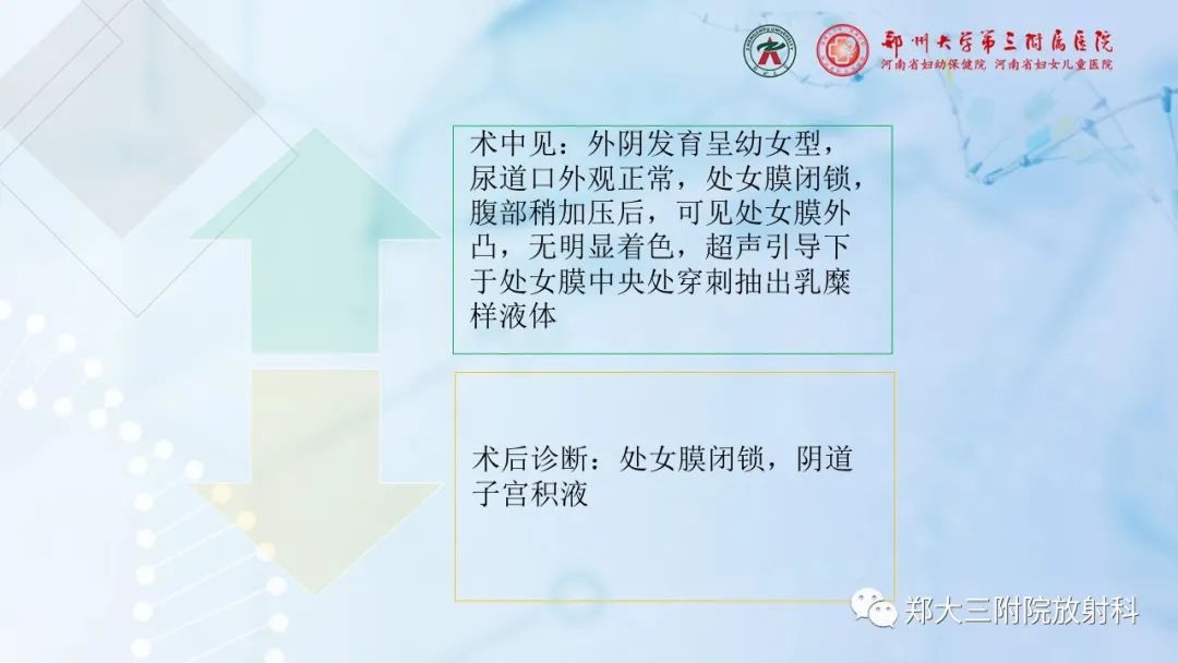 影像PPT - 【PPT】儿童腹部囊性病变诊断思路分析-65