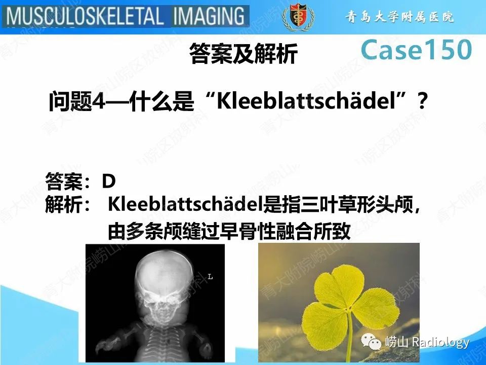 影像PPT - 【PPT】致死性发育不良1型-10