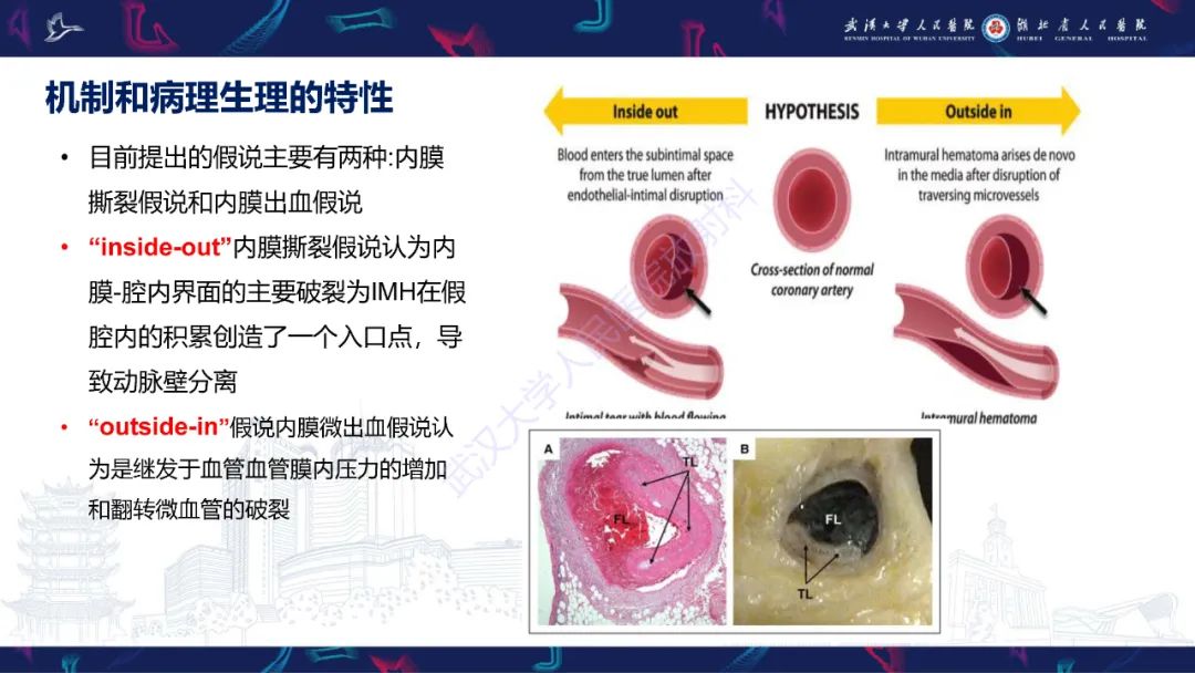 影像PPT - 【PPT】自发性冠状动脉夹层影像诊断-4