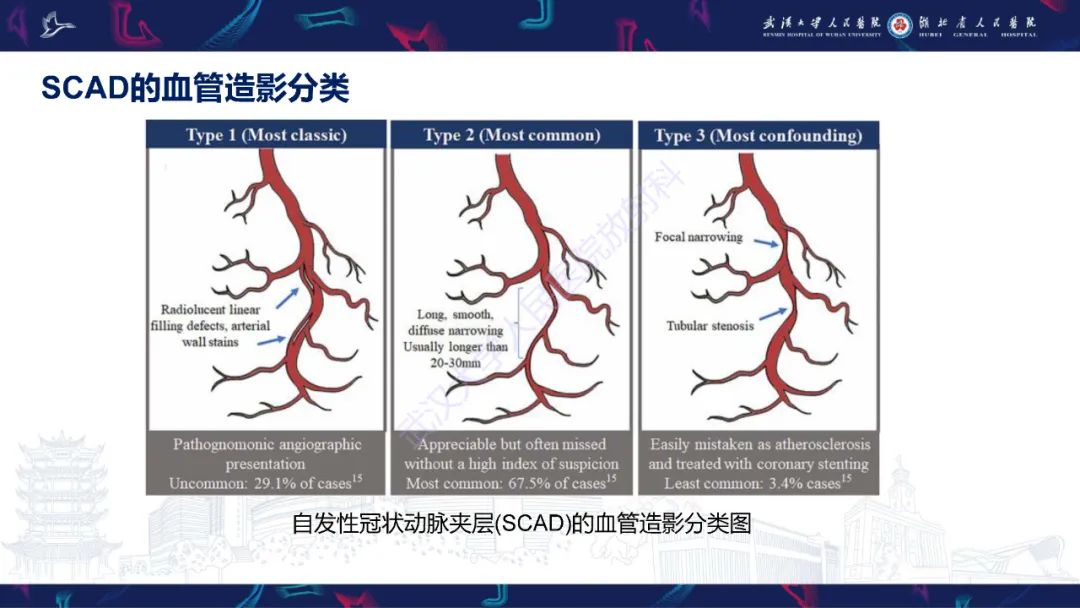 影像PPT - 【PPT】自发性冠状动脉夹层影像诊断-8