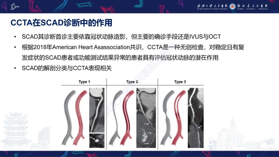 影像PPT - 【PPT】自发性冠状动脉夹层影像诊断-10