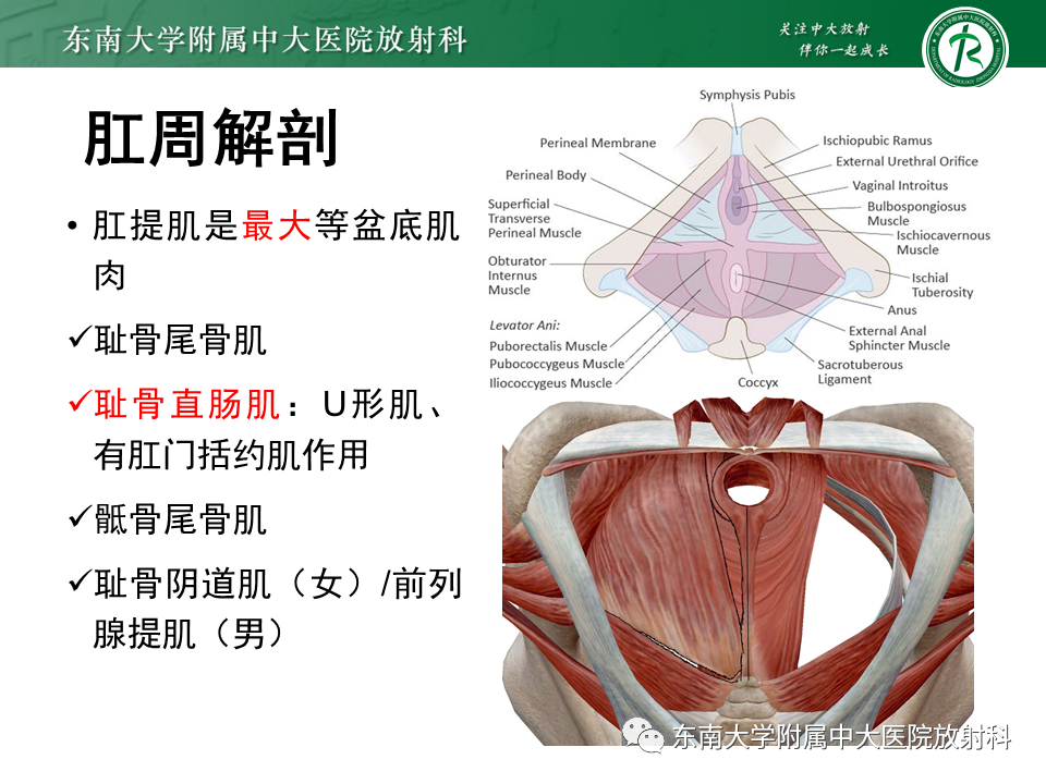 影像PPT - 【PPT】肛瘘的MR诊断-7