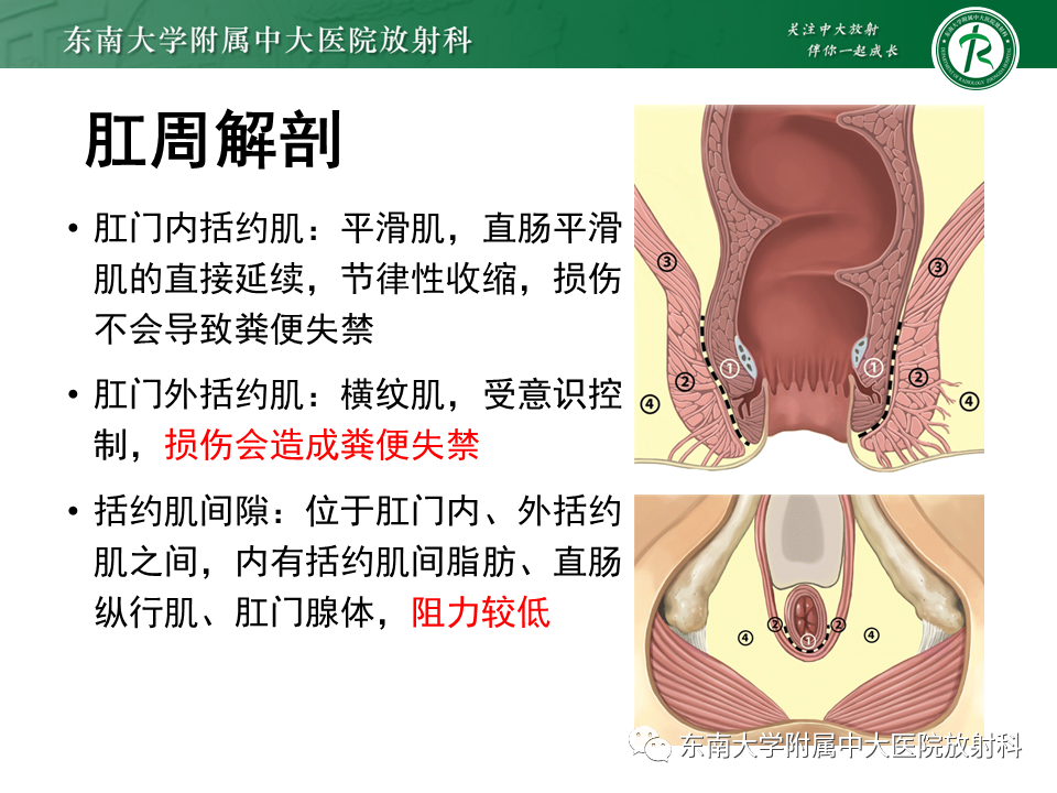 影像PPT - 【PPT】肛瘘的MR诊断-9