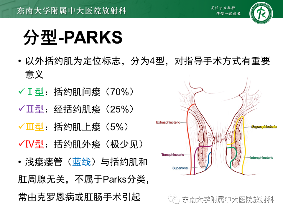 影像PPT - 【PPT】肛瘘的MR诊断-16