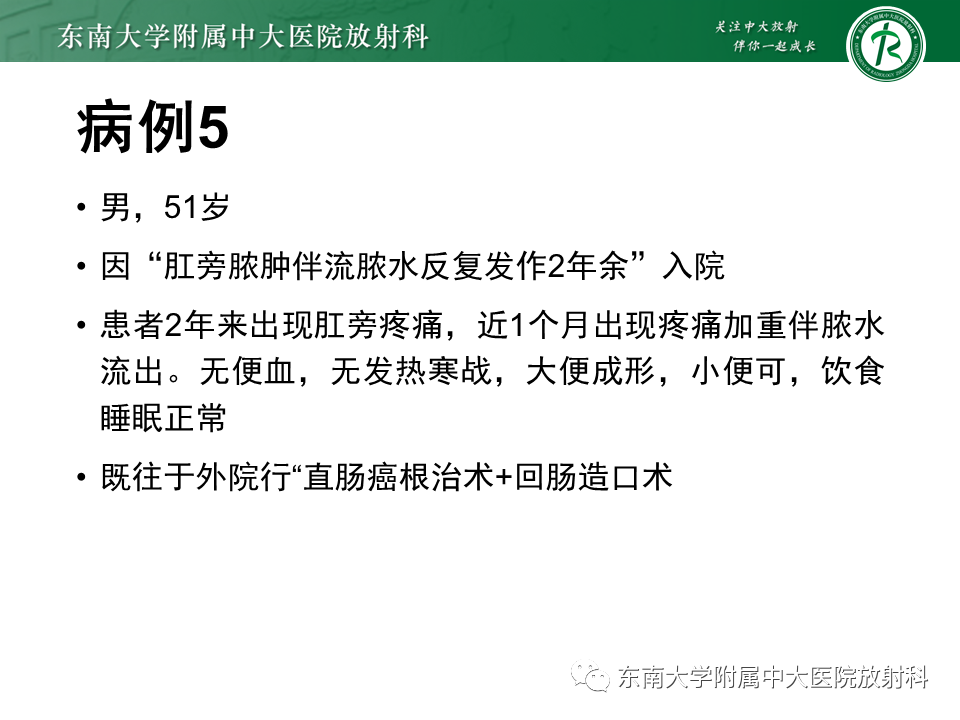 影像PPT - 【PPT】肛瘘的MR诊断-25