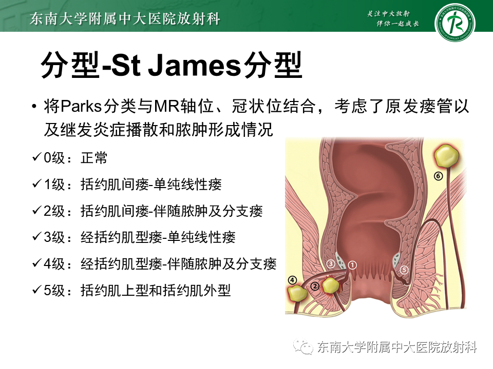 影像PPT - 【PPT】肛瘘的MR诊断-28
