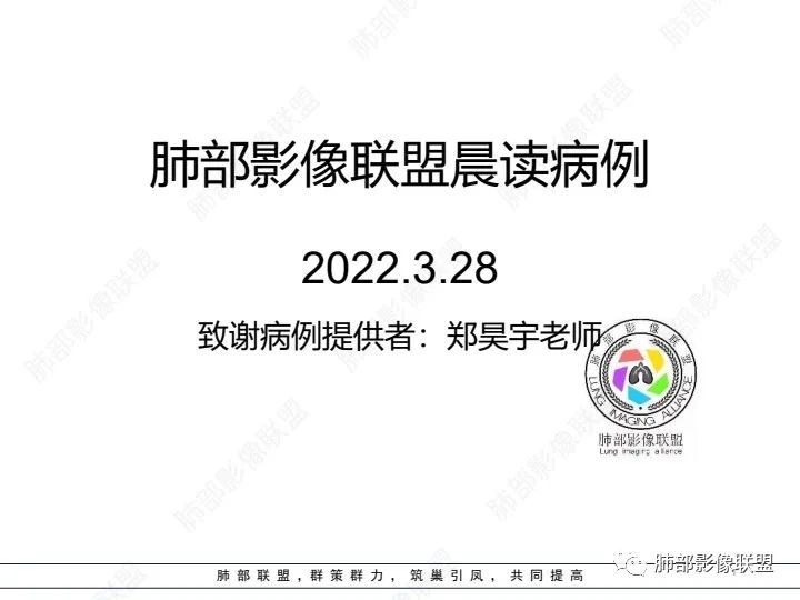影像PPT - 【病例】ANCA相关血管炎1例肺部CT-1 影像PPT - 【病例】ANCA相关血管炎1例肺部CT-1
