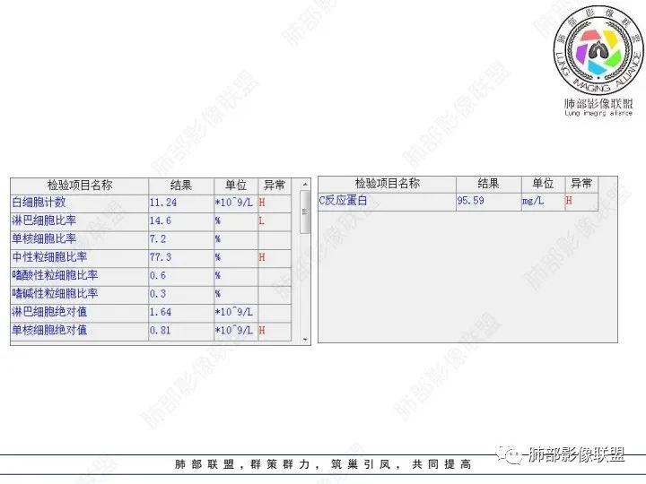 影像PPT - 【病例】ANCA相关血管炎1例肺部CT-3 影像PPT - 【病例】ANCA相关血管炎1例肺部CT-3