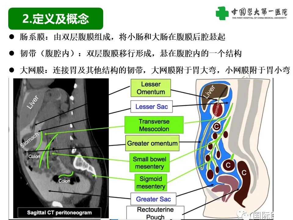 影像PPT - 【PPT】腹腔内游离气体从哪来？如何根据腹膜解剖确定穿孔位置-5