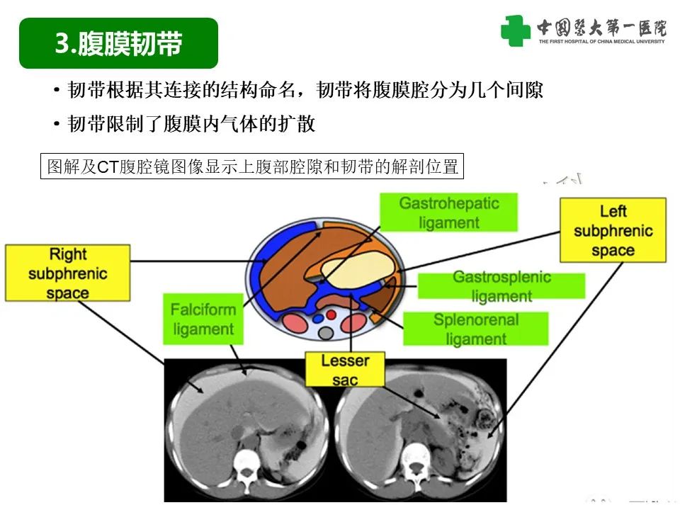 影像PPT - 【PPT】腹腔内游离气体从哪来？如何根据腹膜解剖确定穿孔位置-9