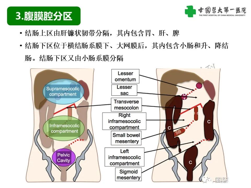 影像PPT - 【PPT】腹腔内游离气体从哪来？如何根据腹膜解剖确定穿孔位置-10